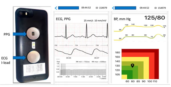 img of Nuevo método de medición de la presión arterial sin manguito.